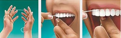 fio-dental
